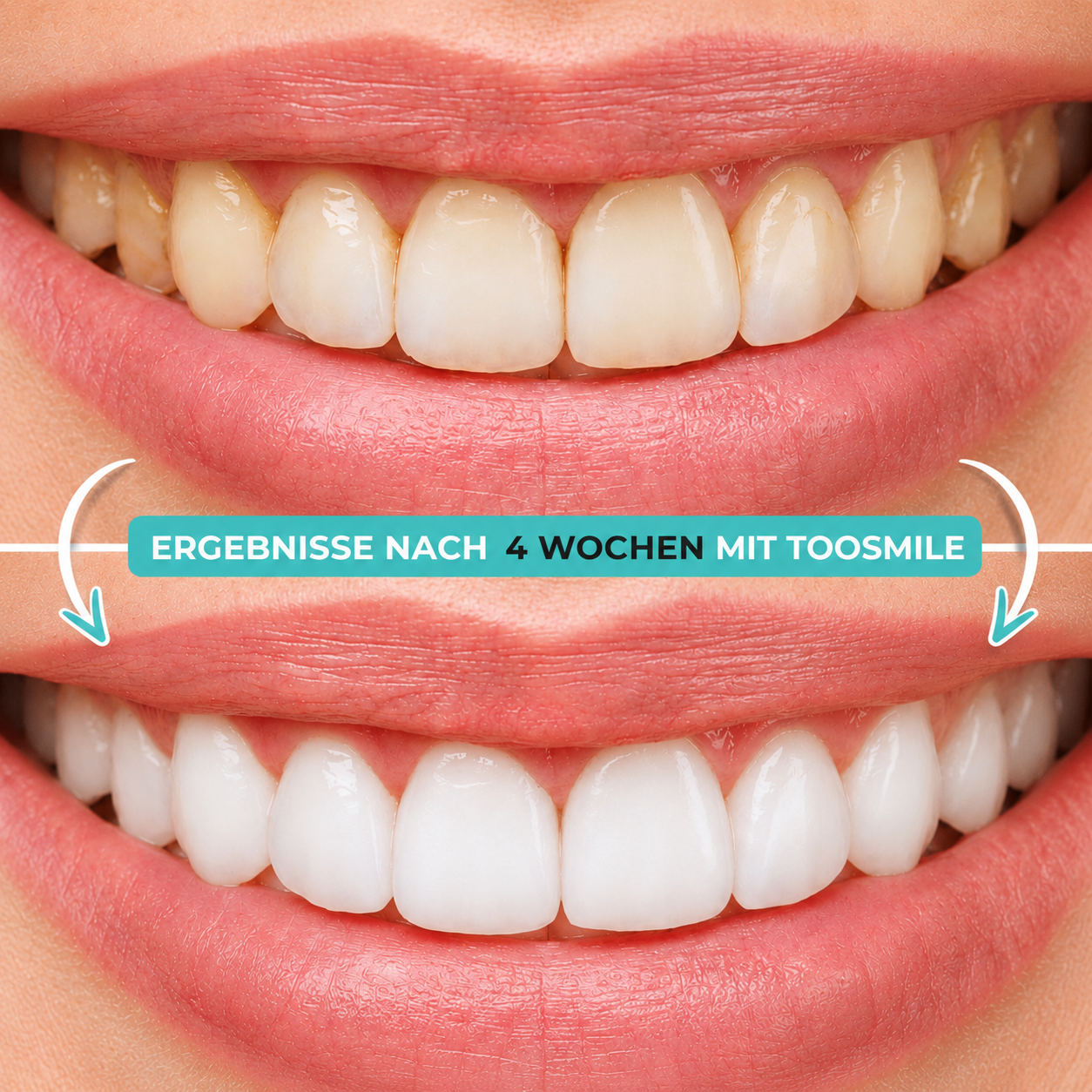 TooSmile Smartbrush